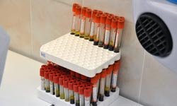 Окно в Европу: свердловский инсулин готов к мировой конкуренции